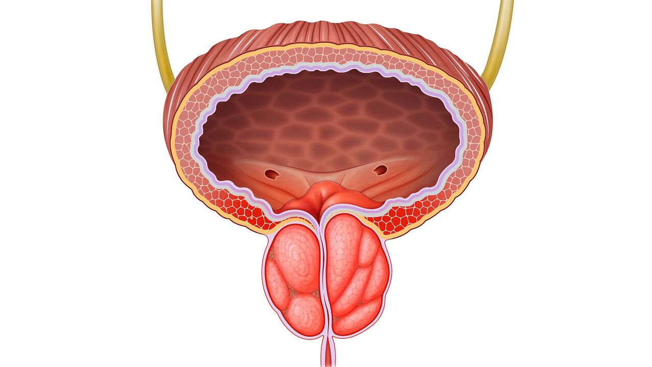 entzündete Prostata